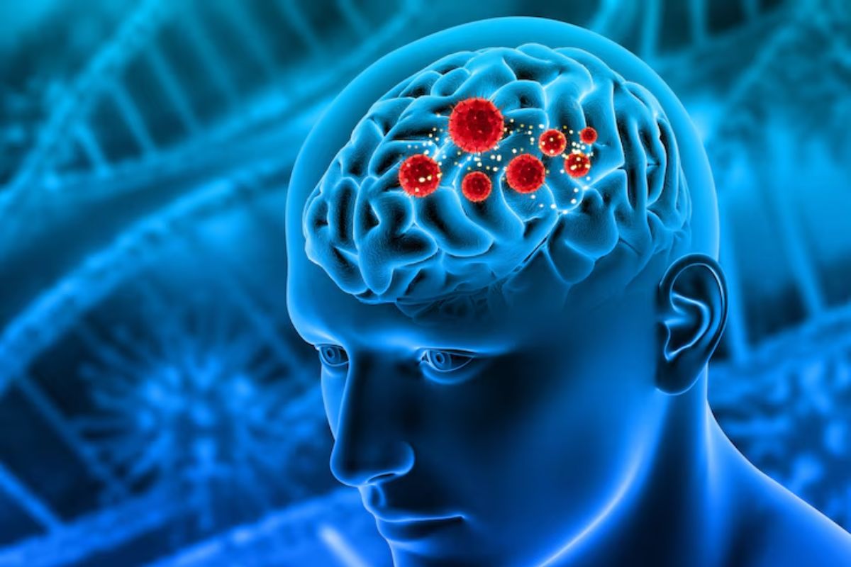 Neurologia em Barra do Piraí